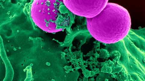CDC raises alarm as deadly Candida auris fungus infections spread across the US