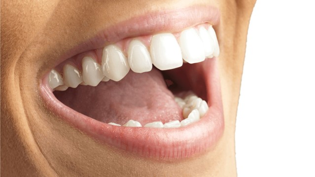 Must do things for healthy teeth and gum - Photo: 3