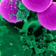 CDC raises alarm as deadly Candida auris fungus infections spread across the US