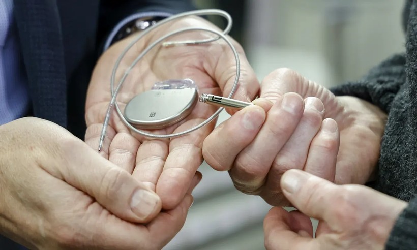 Doctors stole implants from the dead and put them on healthy patients - Photo: 2